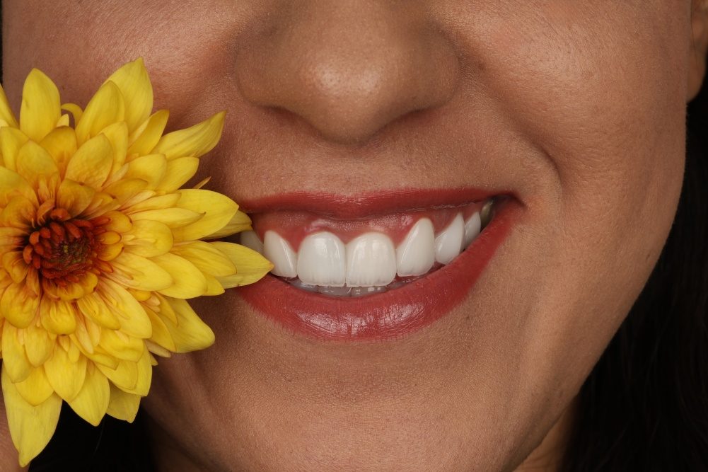 نمونه 1