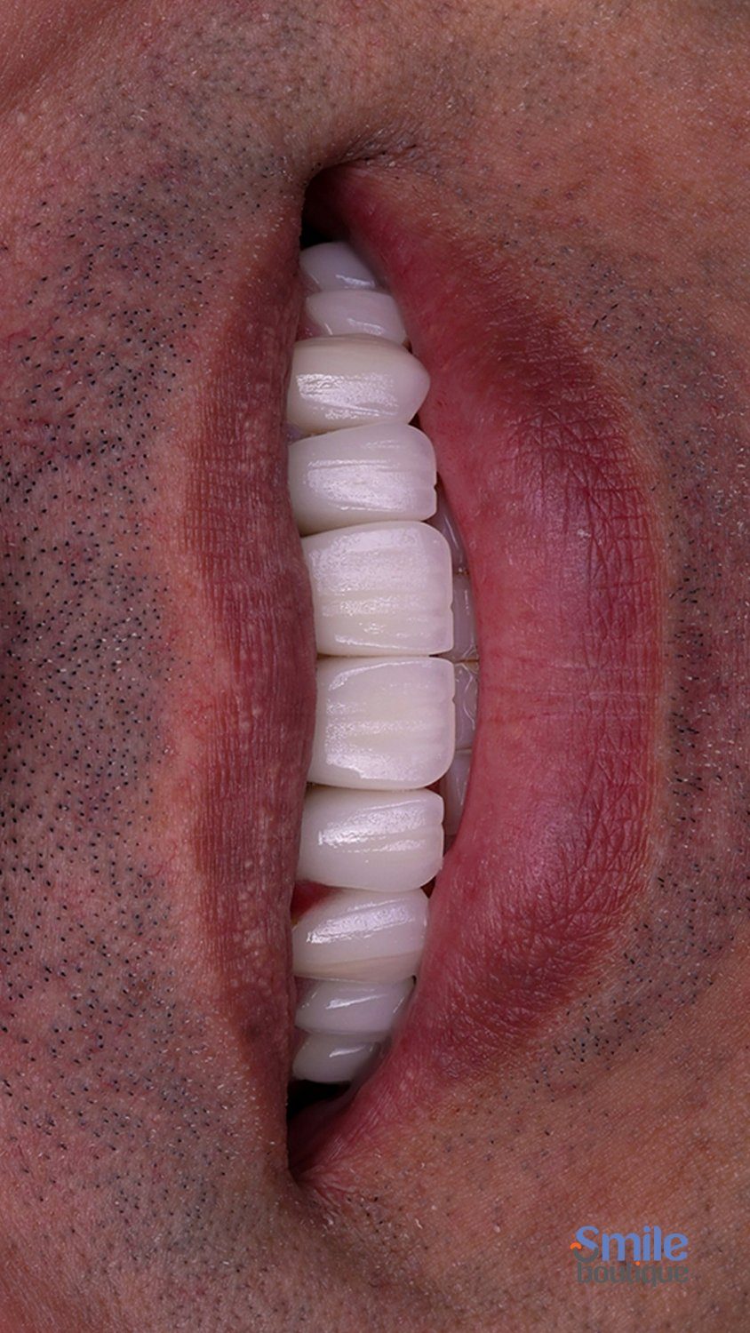نمونه کار